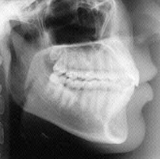 Radiologia Odontológica em Salvador
